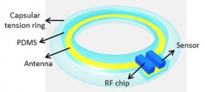 An illustration of the final device. The device would be placed in an artificial lens with its antenna circling the perimeter, and the sensor and radio frequency chip inside. Image U of W