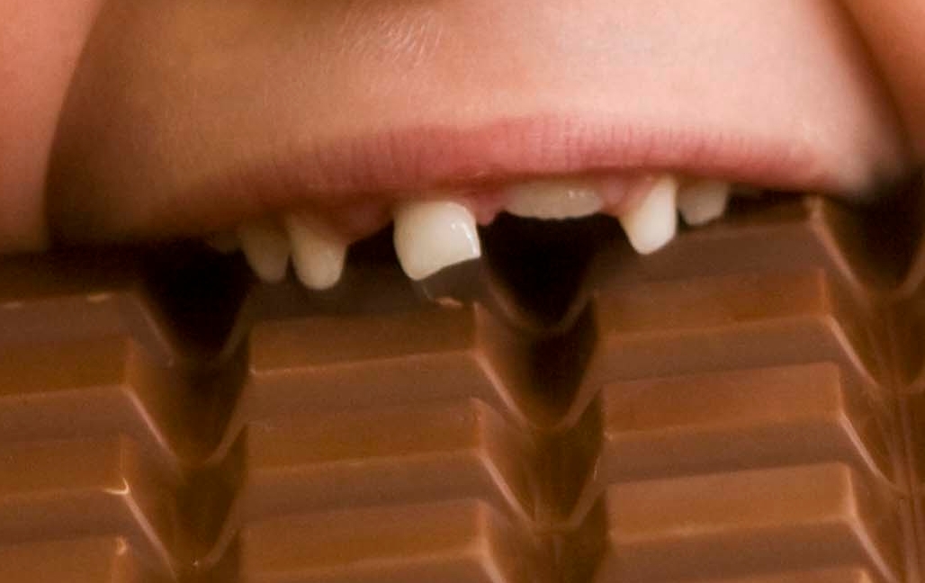 ‘Sugar Papers’ Reveal Industry Role in 1970s Dental Program