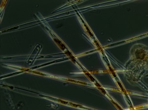 Cells of Pseudo-nitzschia, a genus of microalgae that includes several species that make the neurotoxin domoic acid. NOAA photo courtesy Vera Trainer.