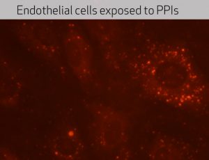 Endothelial cells exposed to PPIs. Image-Houston Methodist
