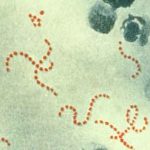 Photmicrograph of Steptococcus Pyrogenes bacteria at 900x magnification. Image-Public Domain