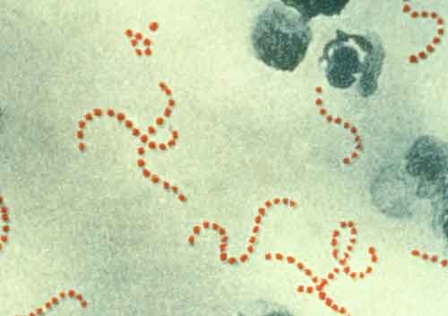 ADHSS Advises Alaska Public of Streptococcus Pyogenes Outbreak