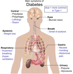 Symptoms of Type 2 Diabetes. Image-Pubic Domain