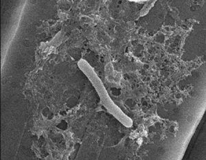 This scanning electron microscope image shows Bacteroidetes bacteria on the algae Pseudo-nitzschia multiseries. Production of the toxin domoic acid seems to depend on the interaction between bacteria and algae. (Image credit: Sison-Mangus Lab)