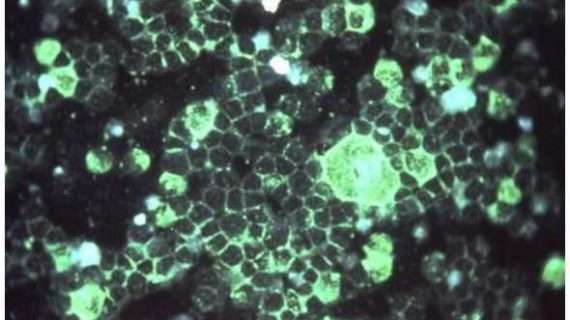 What Alaskans need to know about RSV